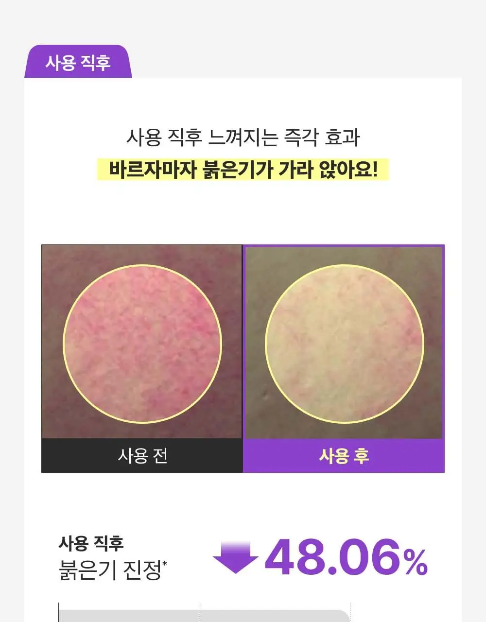 [포켓몬 에디션/잡티미백]성분에디터 머루포도 비타씨 다크 스팟 앰플 40ml 더블기획* 상세페이지 31